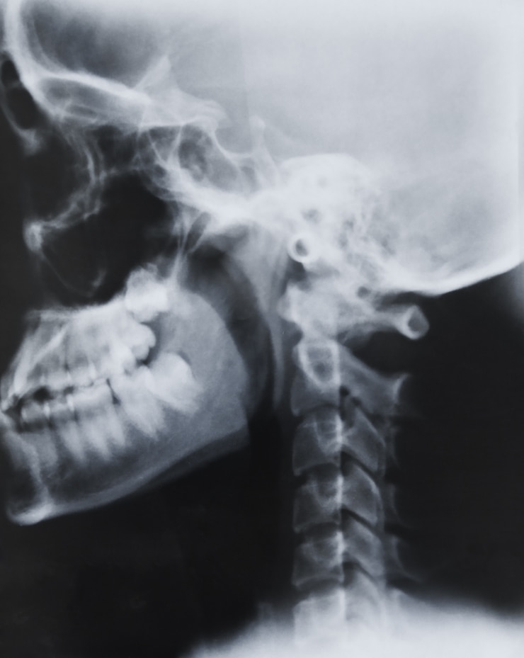 Photo gratuit scientifique diagnostic clinique de chirurgie rachis