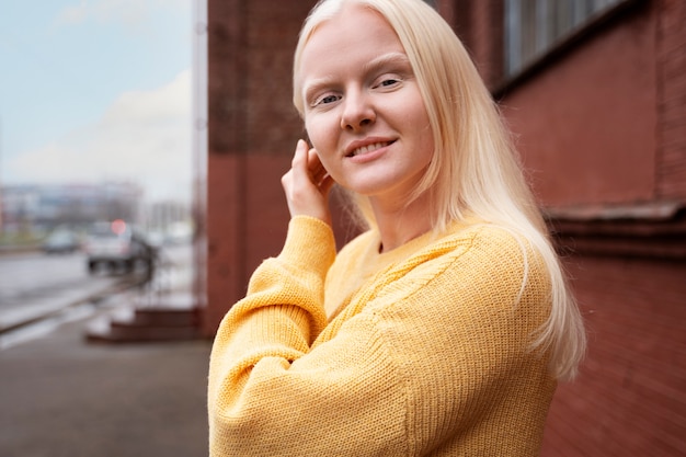 Photo gratuite smiley femme albinos à l'extérieur coup moyen