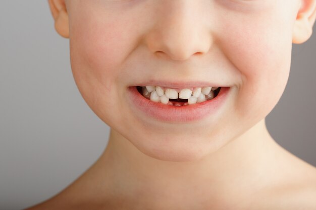 Un Sourire D Enfant Sans Dents De Bebe Inferieures Un Trou Dans Le Sourire D Un Enfant Concept Amusant Photo Premium