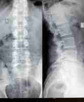 Photo gratuite spine xray