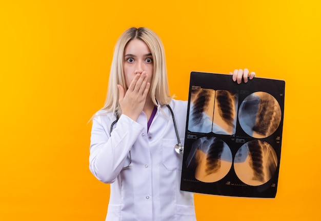 Surpris médecin jeune fille portant un stéthoscope en robe médicale tenant x-ray et bouche couverte avec la main sur fond jaune isolé