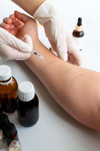 Photo gratuite test de réaction allergique cutanée sur le bras d'une personne