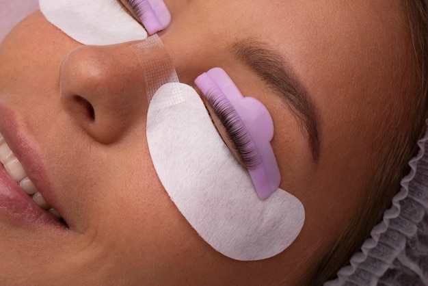 Vue de dessus femme souriante portant des pansements oculaires