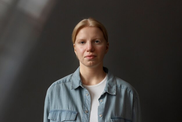 Vue de face femme albinos posant