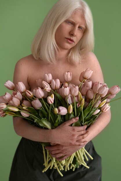 Vue de face femme atteinte d'albinisme posant en studio