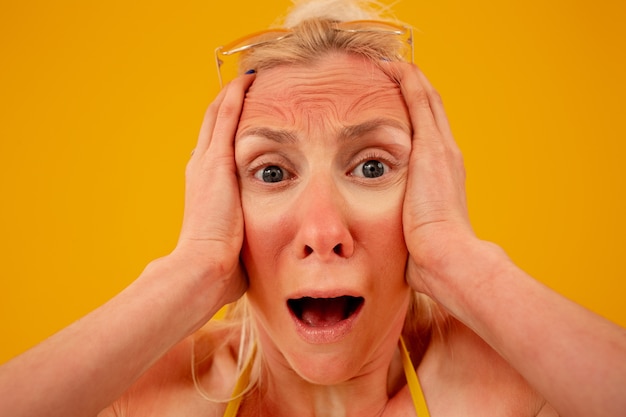 Vue de face femme brûlée par le soleil qui pose en studio