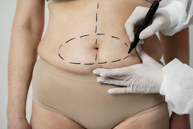 Vue de face femme avec des traces de marqueur sur le ventre
