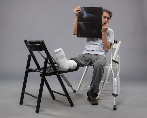 Vue de face jeune homme assis avec un pied cassé et tenant une radiographie de celui-ci sur un bureau gris douleur torsion jambe cassée pied accidenté masculin