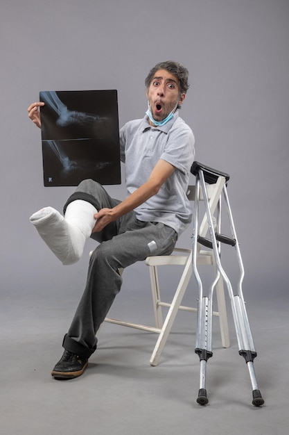 Vue de face jeune homme assis avec un pied cassé et tenant une radiographie de celui-ci sur un mur gris douleur jambes accident pied torsion mâle