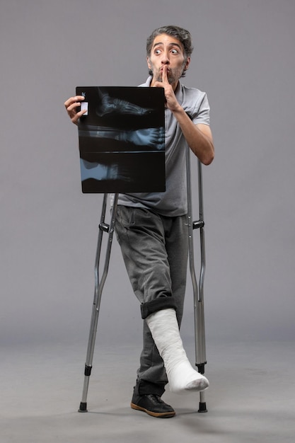 Vue de face jeune homme avec pied cassé à l'aide de béquilles et tenant sa radiographie sur le mur gris douleur désactiver accident torsion du pied cassé