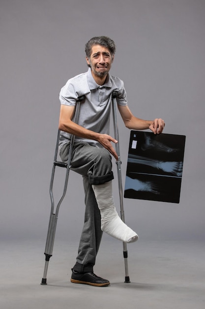 Vue de face jeune homme avec pied cassé à l'aide de béquilles et tenant sa radiographie sur le mur gris douleur désactiver pied accidenté cassé