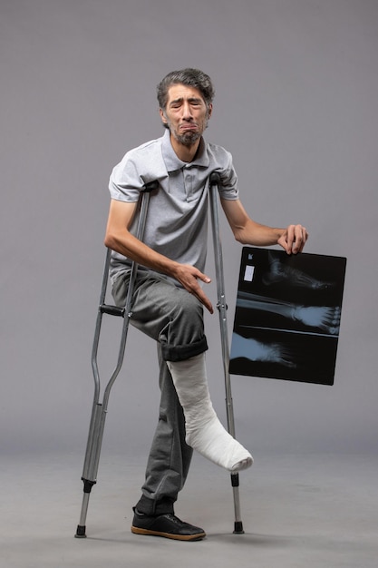 Vue de face jeune homme avec pied cassé à l'aide de béquilles et tenant sa radiographie sur le mur gris douleur désactiver pied accidenté cassé