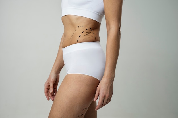 Vue latérale femme avec des traces de marqueur sur la peau
