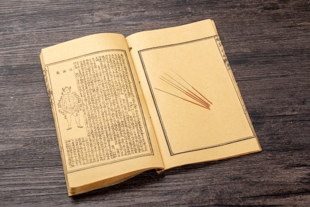 Acupuncture, moxibustion et livres médicaux de médecine traditionnelle chinoise