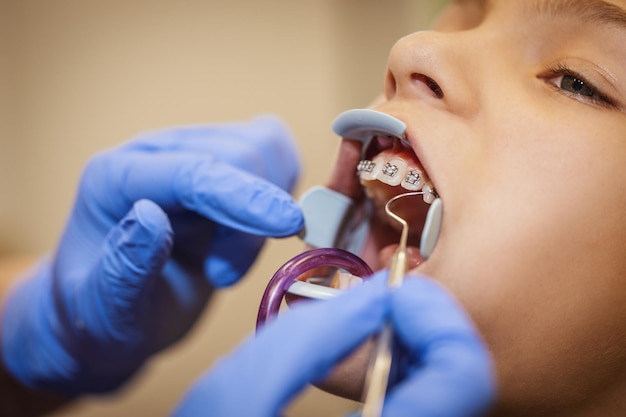 L'adolescente est chez le dentiste. Elle s'assoit dans le fauteuil du dentiste et le dentiste pose des appareils dentaires sur ses dents.