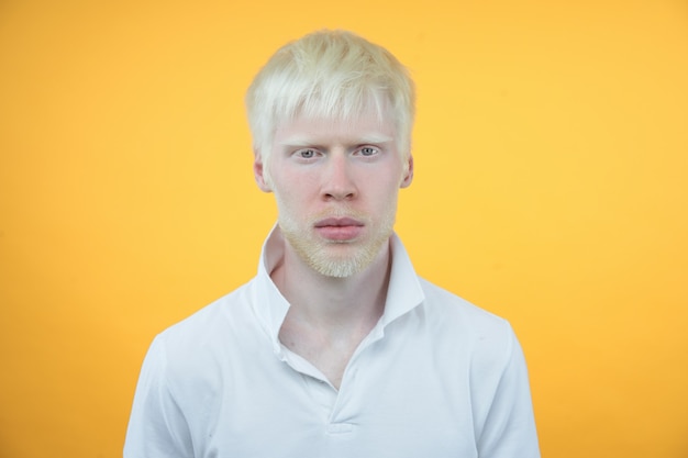 Albinisme homme albinos en studio t-shirt habillé isolé sur fond jaune. écarts anormaux. apparence inhabituelle