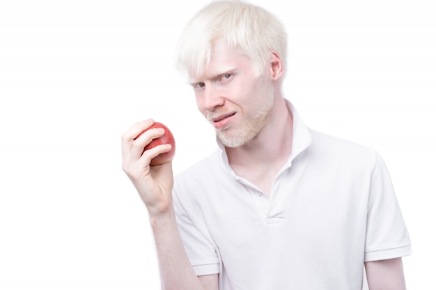 Albinisme homme albinos