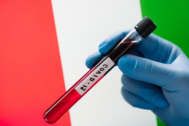 Alerte épidémique Épidémie de coronavirus en Italie Tester un échantillon de sang à la main avec des gants médicaux contre le drapeau italien Un agent de santé tient un tube à essai