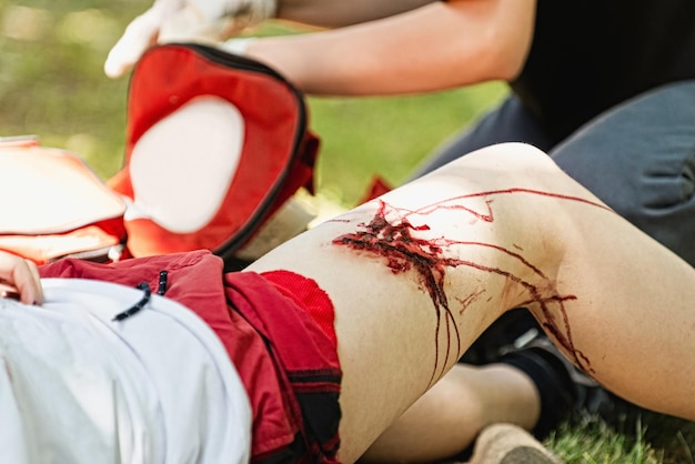 Un ambulancier soignant une blessure grave à la jambe.