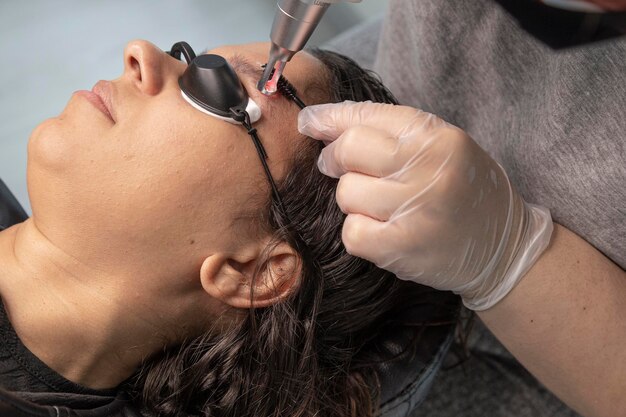 Application laser à une femme pour enlever un tatouage sur son sourcil