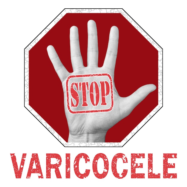 Photo arrêter l'illustration conceptuelle de la varicocèle. ouvrez la main avec le texte stop varicocèle