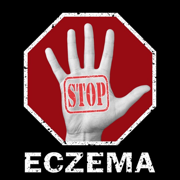 Arrêtez l'illustration conceptuelle de l'eczéma. Ouvrez la main avec le texte stop eczéma