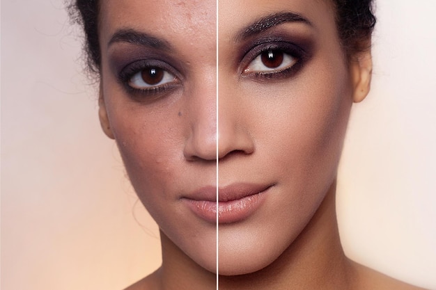 Avant et après l'opération esthétique Jeune jolie femme mulatte à la peau foncée portrait studio photo fond lumineux Avant et après la procédure plastique thérapie anti-âge en regardant dans l'objectif