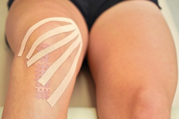 Bande de kinésiologie dans la couleur du corps coupée en fines rayures appliquées sur le genou de la patiente, gros plan sur les détails.
