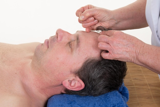 Beau jeune homme dans une thérapie d'acupuncture