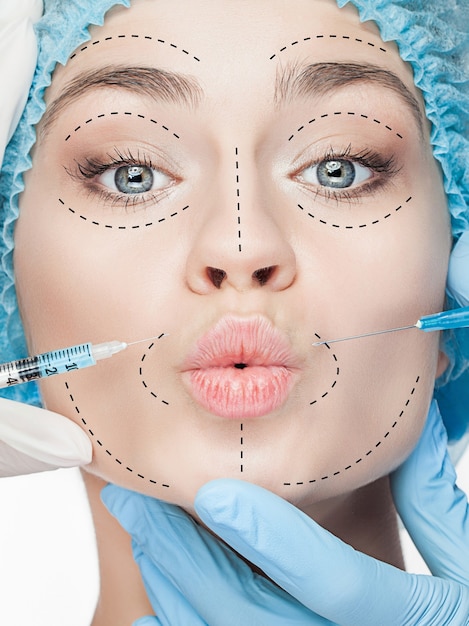 Le beau visage féminin avec des lignes pendant l'opération de chirurgie plastique de la cosmétologie