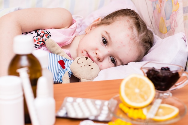 Un bébé au lit qui a la varicelle et de la drogue devant lui sur la table