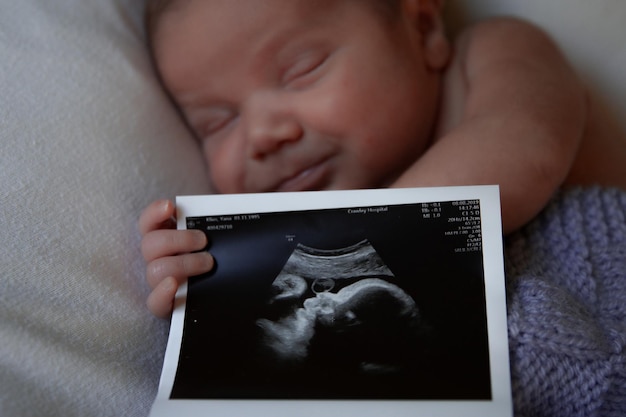 Un bébé tient une image échographique.