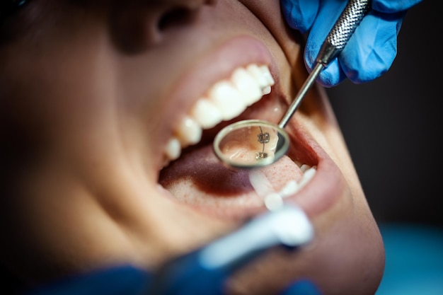 La belle jeune femme est chez le dentiste. Elle est assise dans le fauteuil du dentiste et le dentiste répare ses dents. Fermer.