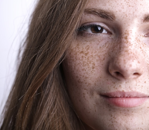 Belles taches de rousseur sur une peau