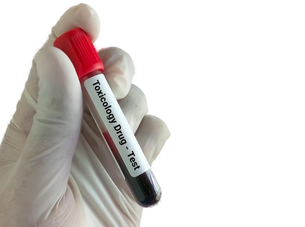 Biochimiste tenant un échantillon de sang sur fond blanc pour les tests de toxicologie.