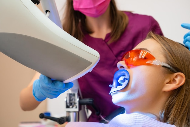 Blanchiment des dents pour les femmes et application du laser pour le blanchissement des dents à la clinique dentaire