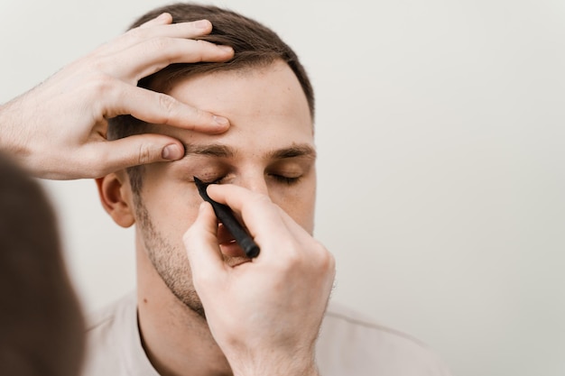 Blépharoplastie pour l'homme balisage sur le visage avant l'opération de chirurgie plastique pour modifier la région oculaire en clinique médicale