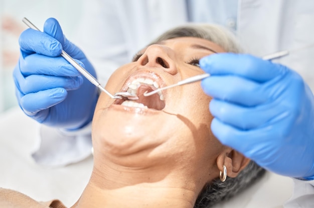 Bouche de femme et mains de dentiste avec des outils de procédure médicale et dentaire soins de santé et gros plan orthodontie de santé bucco-dentaire et patient avec blanchiment des dents du médecin et facettes avec instrument métallique