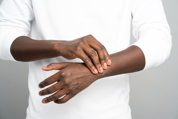 Bras de l'homme tenant le poignet douloureux souffrant d'arthrite du syndrome du canal carpien close up