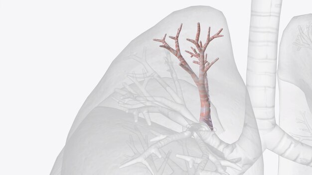 Le bronche segmenté apical est le bronche le plus supérieur de l'aspect postérieur de l'arbre bronchique. Par conséquent, ce segment est particulièrement