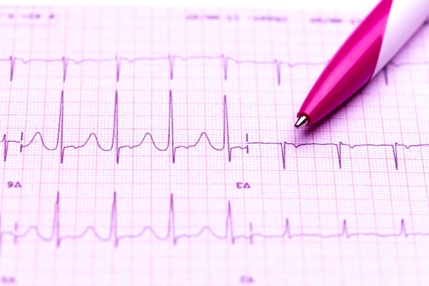 Photo cardiogramme et stylo technique