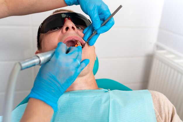 Caries dentaires Remplissage avec un matériau photopolymère composite dentaire à l'aide de rabbders Le concept de traitement dentaire dans une clinique dentaire