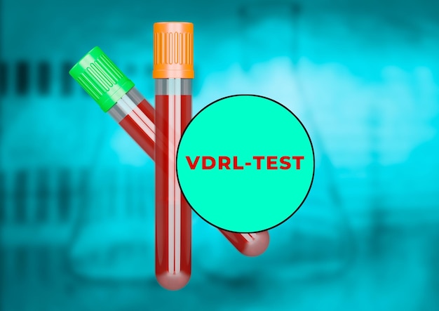 Échantillon de sang humain dans le tube pour test VDRL