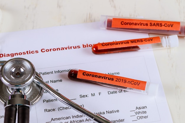 Échantillon de sang pour test de coronavirus et stéthoscope