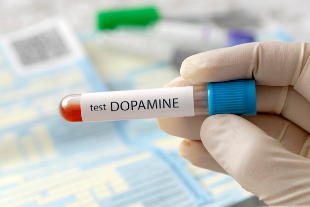 Échantillon de sang pour test de dopamine sur fond de laboratoire bleu