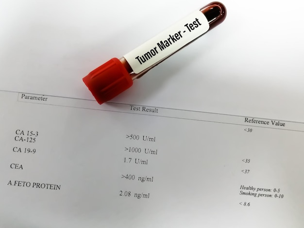 Échantillon de sang pour test de marqueur de cancer ou test de marqueur tumoral avec rapport de laboratoire anormal