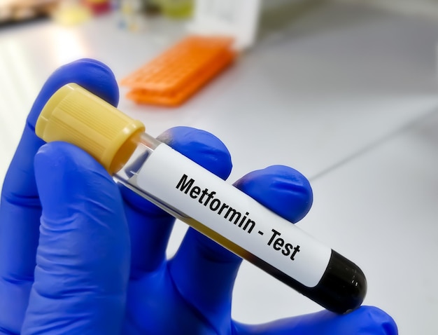 Échantillon de sang pour le test de niveau de médicament metformine pour définir la plage thérapeutique pour le patient diabétique