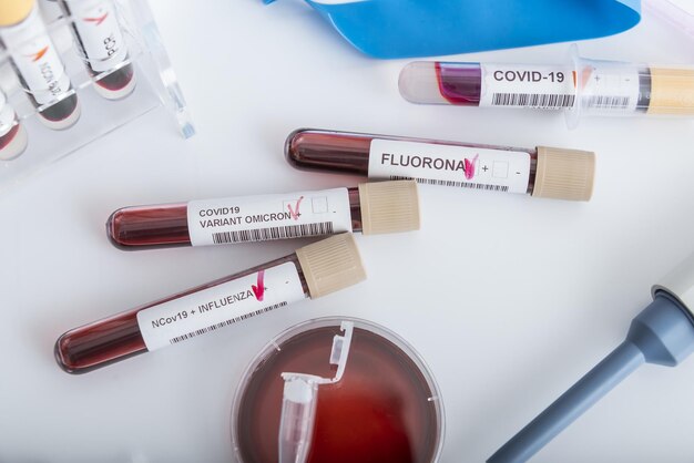 Échantillons de sang de la nouvelle variante OMICRON plus grippe FLUORONE, covid19, coronavirus. Approche sélective du tube échantillon.