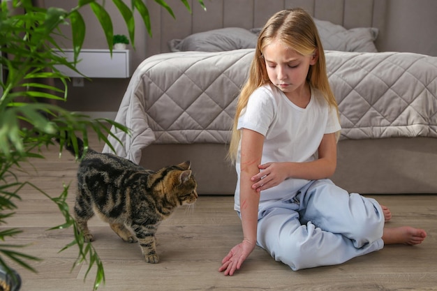 Le chat a gratté la main de l'enfant