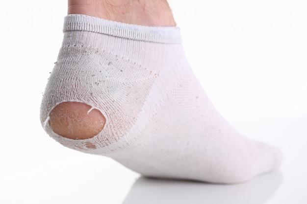 Chaussette blanche déchirée sur la jambe masculine isolée